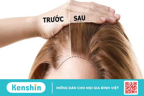 Dầu hạt lanh có thể chăm sóc tóc không?