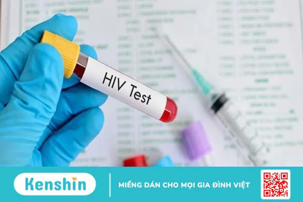 Dấu hiệu HIV sớm theo từng giai đoạn giúp điều trị hiệu quả