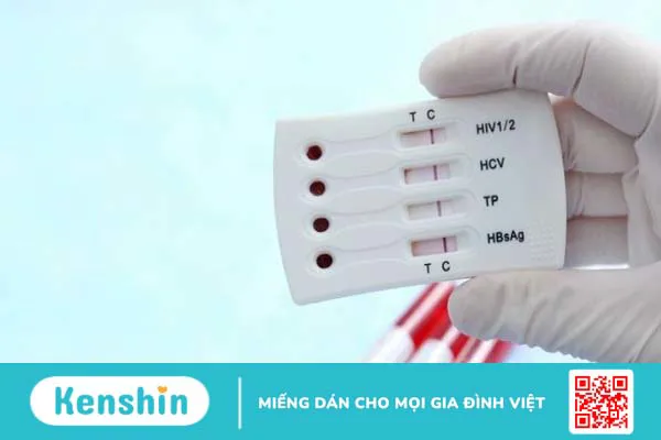 Dấu hiệu HIV sớm theo từng giai đoạn giúp điều trị hiệu quả