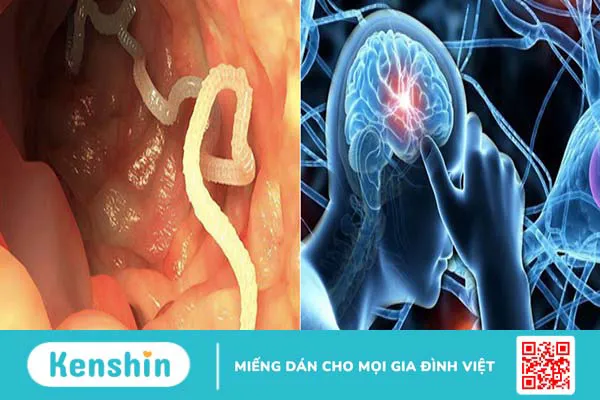 Dấu hiệu nhận biết và chẩn đoán chính xác bị nhiễm sán lợn