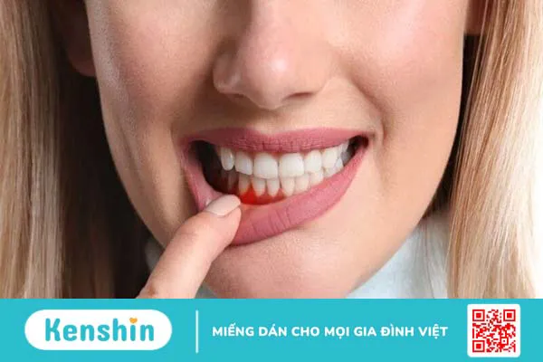 Đau họng 1 bên là bệnh gì? Nguyên nhân gây đau họng 1 bên và giải pháp