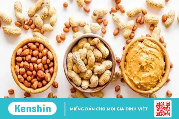 Đậu phộng bao nhiêu calo? Ăn đậu phộng có béo không?