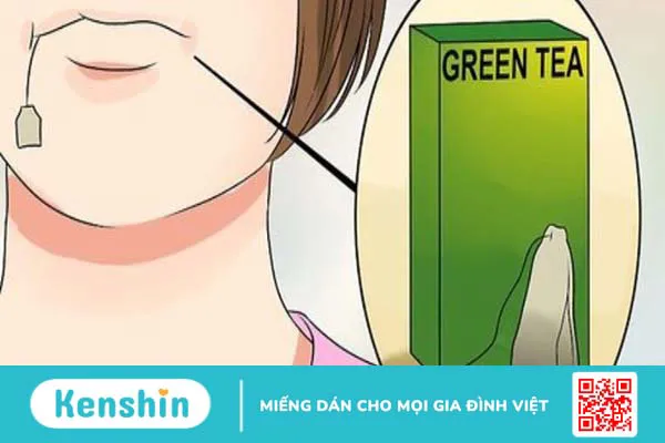 Đau răng khôn nên làm gì? 9 cách giảm đau răng khôn nhanh, hiệu quả