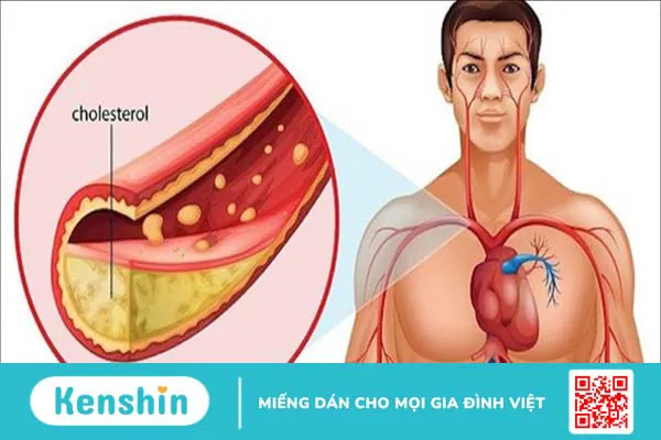 Dây thìa canh có tác dụng gì? Cách sử dụng cây thìa canh tốt cho người tiểu đường