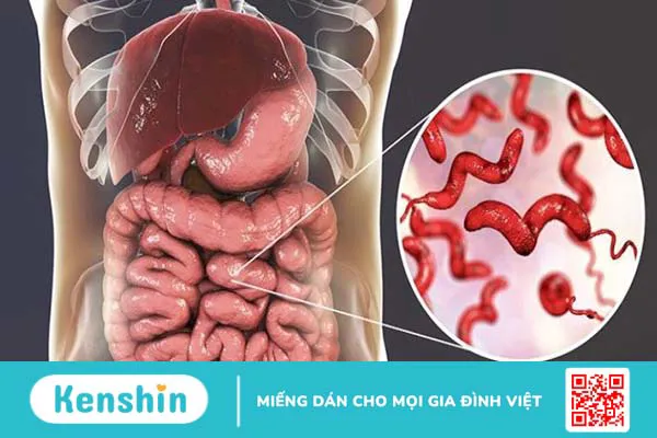 Đi cầu ra máu có thể là biểu hiện của 13 bệnh gì? Xem ngay