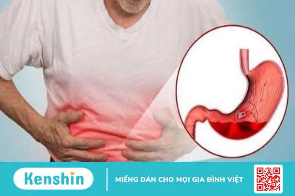 Đi cầu ra máu có thể là biểu hiện của 13 bệnh gì? Xem ngay