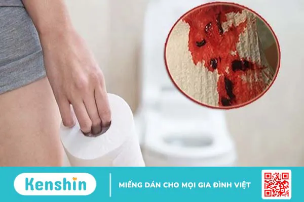 Đi ngoài ra máu nên, kiêng ăn gì để mau khỏi? Gợi ý 8 loại thực phẩm