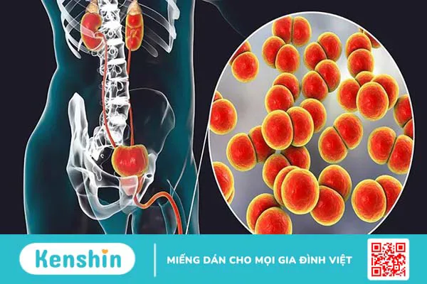 Đi tiểu ra máu là bệnh gì? 8 nguyên nhân tiểu ra máu bạn nên biết