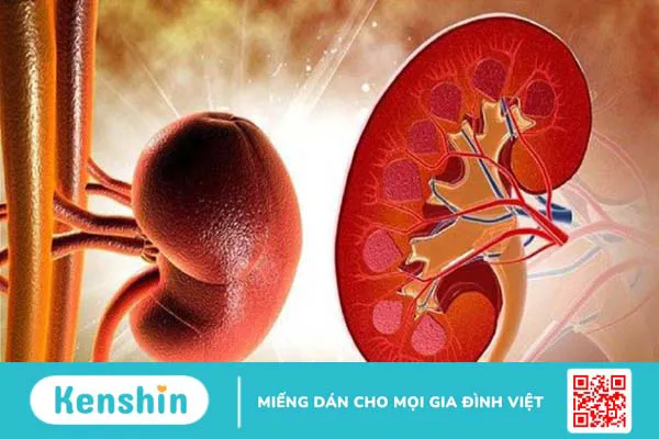 Đi tiểu ra máu là bệnh gì? 8 nguyên nhân tiểu ra máu bạn nên biết