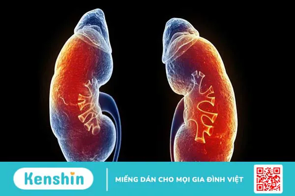 Đi tiểu ra máu là bệnh gì? 8 nguyên nhân tiểu ra máu bạn nên biết