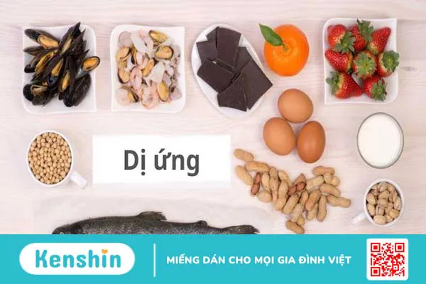 Dị ứng da mặt phải làm sao? 5 cách trị dị ứng da mặt tại nhà đơn giản