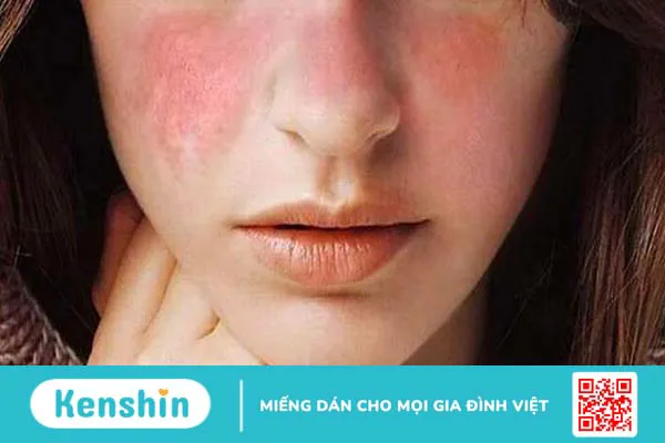 Dị ứng mỹ phẩm: Dấu hiệu nhận biết và cách xử lý kịp thời cho da