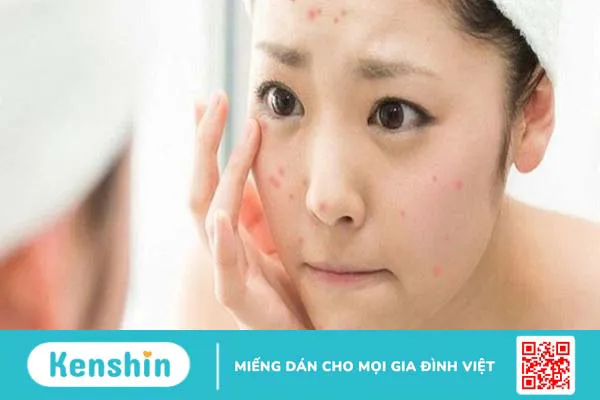 Dị ứng mỹ phẩm: Dấu hiệu nhận biết và cách xử lý kịp thời cho da