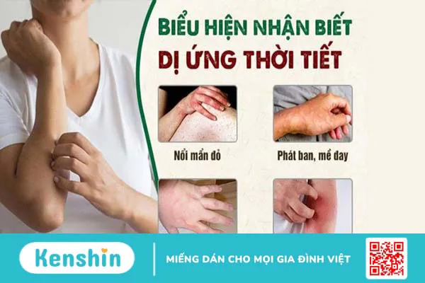 Dị ứng thời tiết có nguy hiểm không? Các dấu hiệu dị ứng thời tiết