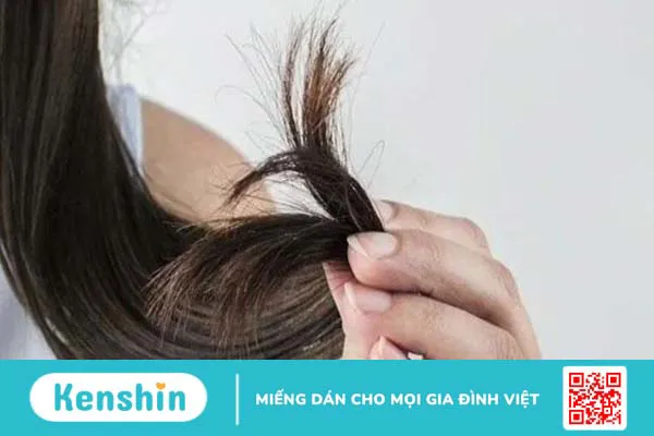 Điểm qua 16 triệu chứng hạ canxi máu bạn không thể bỏ qua