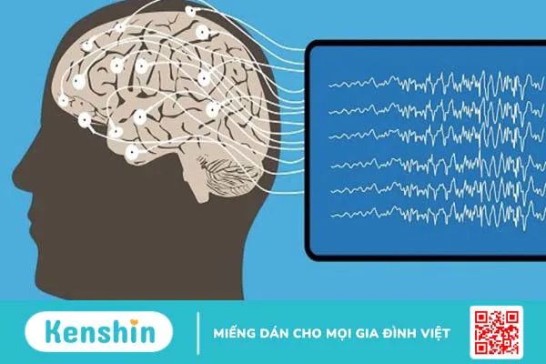 Điện não đồ là gì? Tác dụng của điện não đồ trong khám chữa bệnh