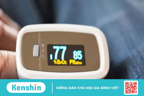 Điều trị COVID-19 bao lâu thì khỏi? 4 giai đoạn nhiễm COVID-19