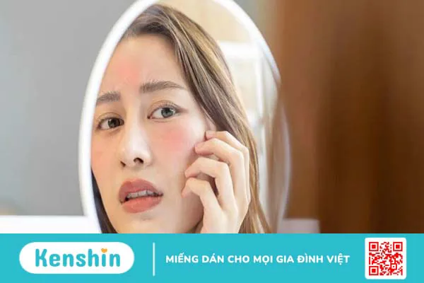 Dùng kem chống nắng bị mụn? 7 nguyên nhân gây mụn và cách khắc phục