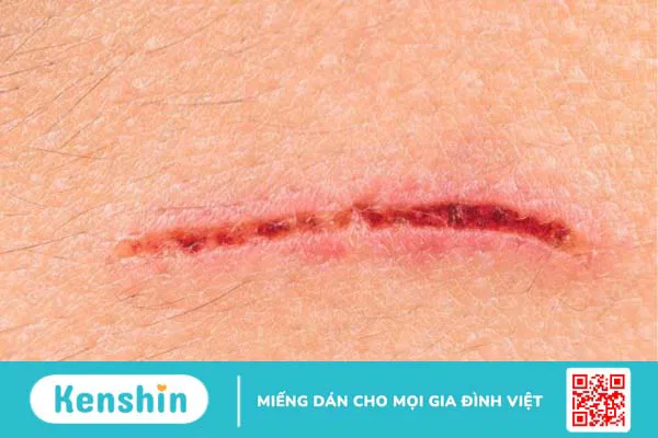 Elastin là gì? 6 tác dụng của elastin đối với làn da bạn nên biết