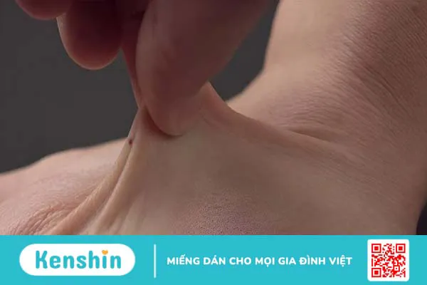 Elastin là gì? 6 tác dụng của elastin đối với làn da bạn nên biết