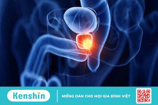 EPA là gì? 8 tác dụng, cách dùng, tác dụng phụ của EPA đối với cơ thể bạn cần biết