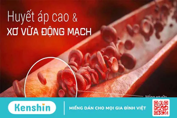 Fruitflow là gì? Công dụng của fruitflow đối với sức khỏe tim mạch