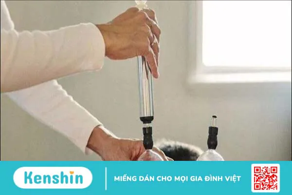 Giác hơi có tác dụng gì? Phương pháp và đối tượng không nên giác hơi