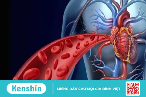 Giác hơi có tác dụng gì? Phương pháp và đối tượng không nên giác hơi