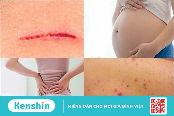 Giác hơi có tác dụng gì? Phương pháp và đối tượng không nên giác hơi