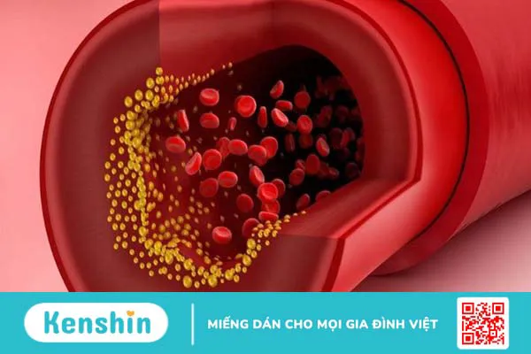 Giấm táo có giúp điều trị bệnh tăng huyết áp không?