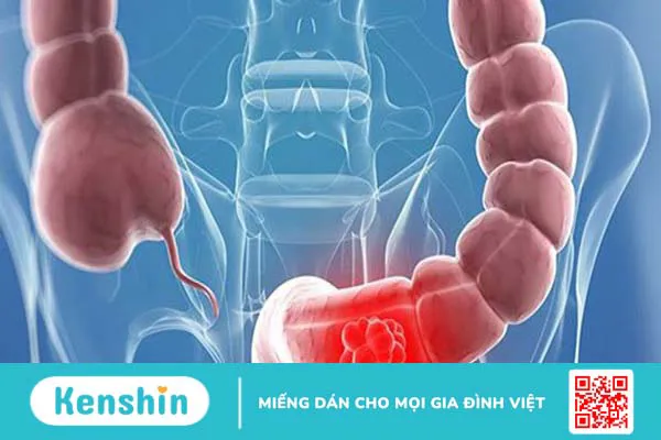 Giấm táo là gì, tác dụng, cách dùng, lưu ý khi sử dụng giấm táo