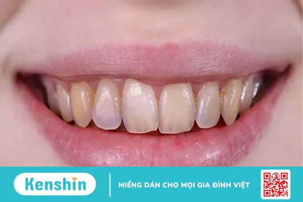 Giấm táo là gì, tác dụng, cách dùng, lưu ý khi sử dụng giấm táo