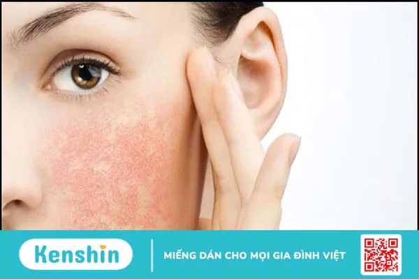 Giấm táo là gì, tác dụng, cách dùng, lưu ý khi sử dụng giấm táo