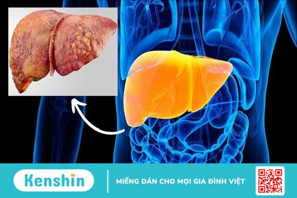 Giảo cổ lam có tác dụng gì? Lưu ý khi sử dụng