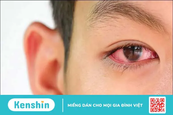 Giới thiệu thuốc nhỏ mắt V.Rohto có tốt không?