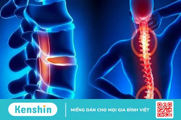 Giới thiệu viên uống bổ xương khớp Khương Thảo Đan mua ở đâu, có tốt không?