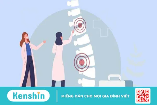 Giới thiệu viên xương khớp Vương Hoạt mua ở đâu, có tốt không?