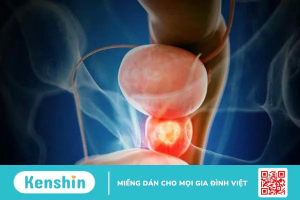 Hạt bí ngô là gì? 13 tác dụng của hạt bí ngô đối với sức khỏe