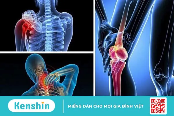 Hạt dẻ cười có tác dụng gì? 16 tác dụng của hạt dẻ cười bạn nên biết