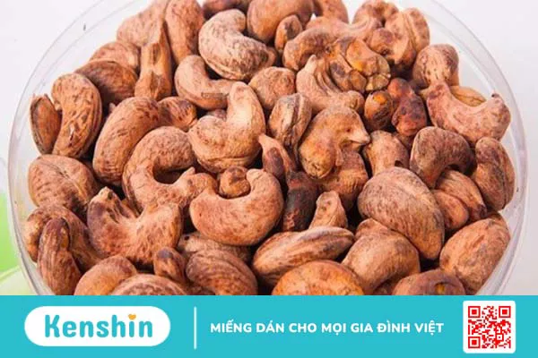 Hạt điều bao nhiêu calo? Ăn hạt điều có béo không? Lưu ý khi ăn