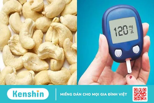 Hạt điều có tác dụng gì? 18 tác dụng của hạt điều và các lưu ý khi ăn