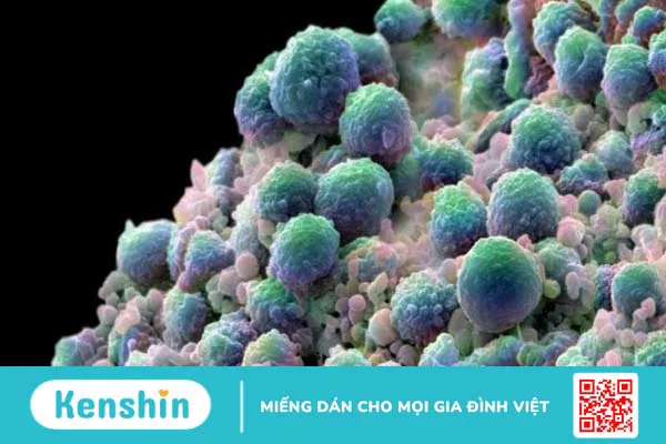 Hạt dưa bao nhiêu calo? Ăn hạt dưa có tốt không và các lưu ý khi ăn