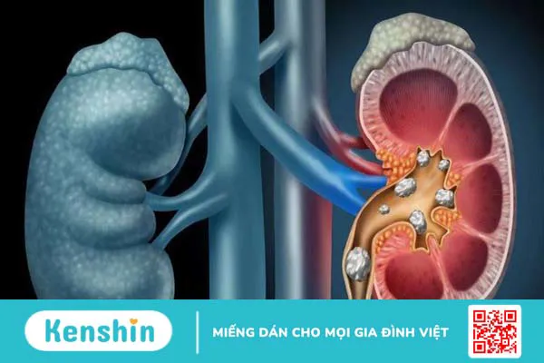 Hạt mã tiền có tác dụng gì? 9 bài thuốc và lưu ý khi chữa bệnh