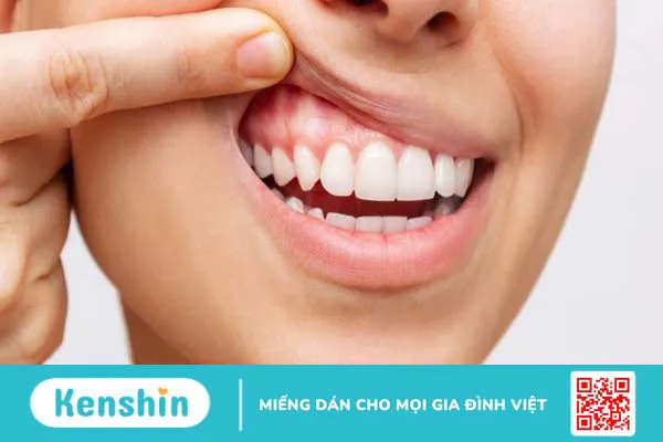 Hạt sen có tác dụng gì? 20 công dụng và các món ăn tốt cho sức khỏe