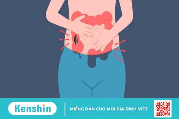 Hậu môn nhân tạo là gì? Các loại hậu môn nhân tạo và lưu ý chăm sóc