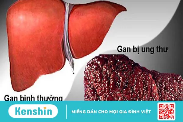 Hiến máu có tốt không? 9 lợi ích của hiến máu nhân đạo với sức khỏe