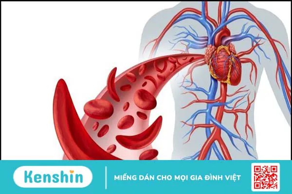 Hiến máu có tốt không? 9 lợi ích của hiến máu nhân đạo với sức khỏe