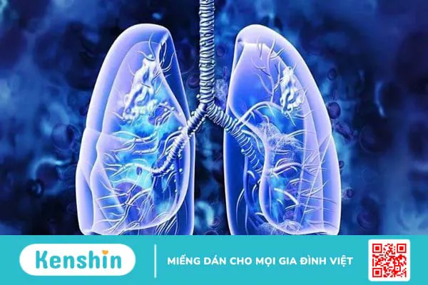 Hiến máu có tốt không? Có ảnh hưởng sức khoẻ không? Lưu ý khi hiến máu