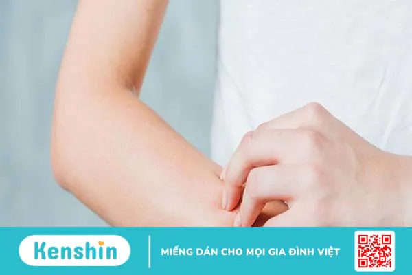 Hiểu đúng về sốc phản vệ sau khi tiêm Vaccine ngừa COVID-19