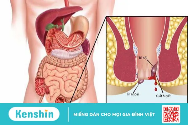 Hoa hòe có tác dụng gì? 7 Lợi ích đối với sức khỏe và những lưu ý